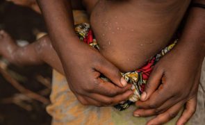 Mpox: Alemanha anuncia donativo de 100 mil vacinas para África