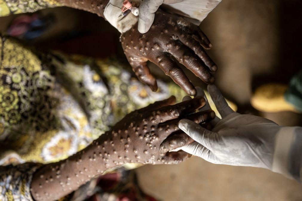 Mpox já infetou 38.300 pessoas e matou 979 desde o início do ano em África