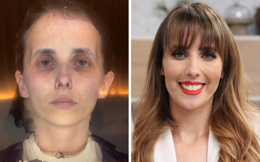 De «caveira» a mulher A transformação brutal de Ana que deixou todos de boca aberta