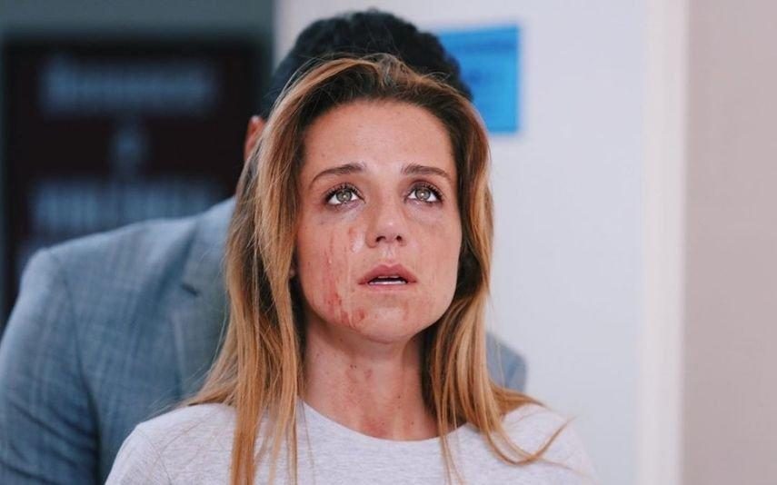 Inês Herédia ficou com infeção nos olhos 