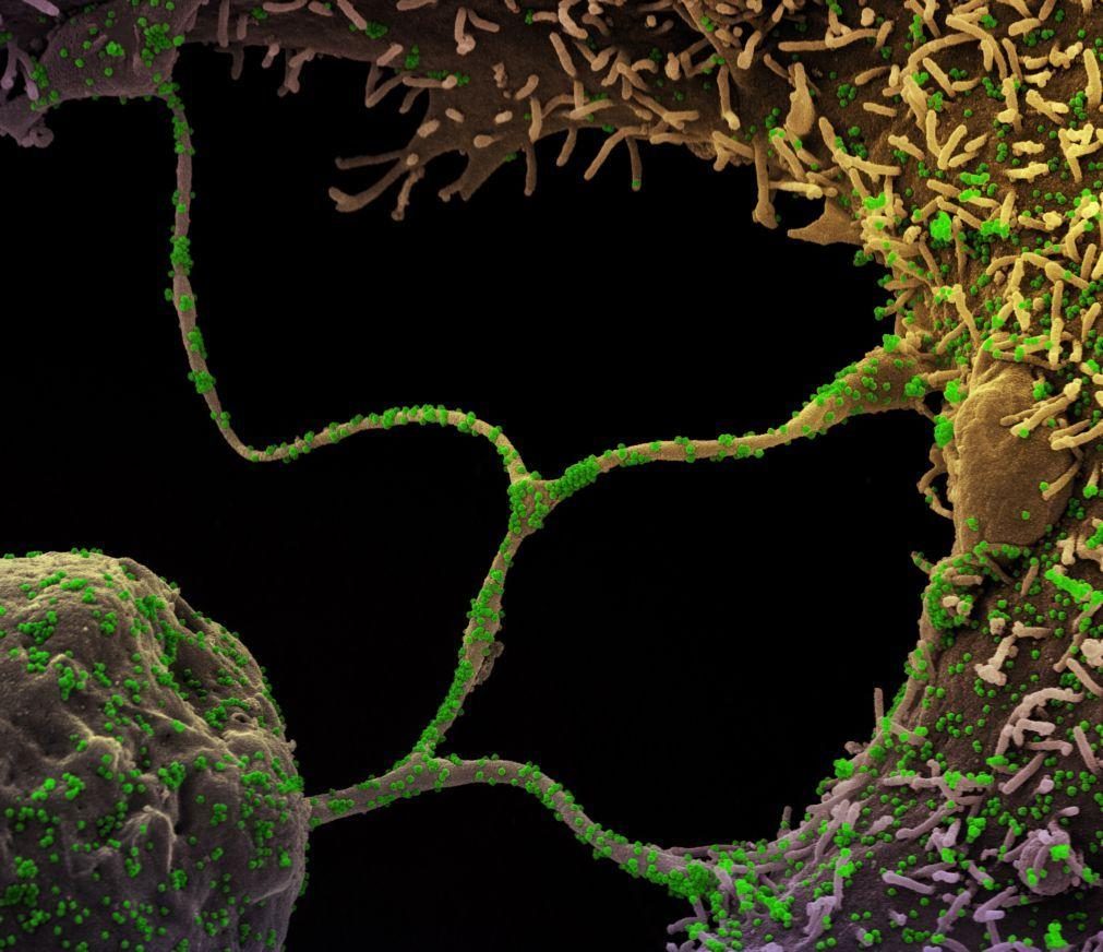 Covid-19: Aparecimento de novas variantes é expectável, diz microbiologista